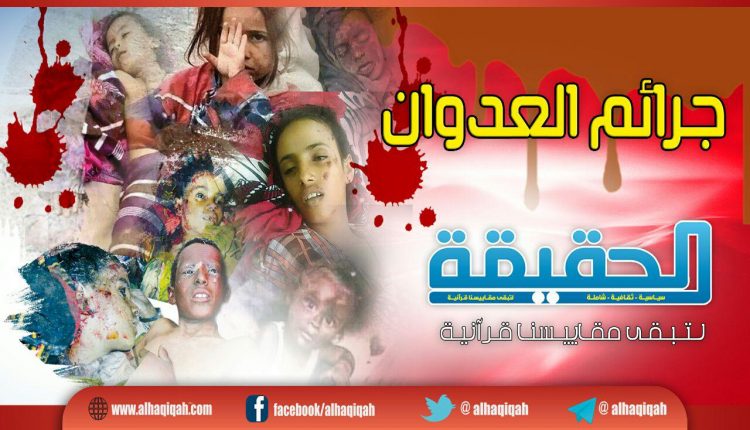 رصد خروقات وجرائم العدوان الأمريكي السعودي والخونة ليوم الإثنين (19-جمادى الآخر-1442)هـ الموافق (01-02-2021)م