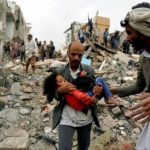 العدوان على اليمن وصمة العار على جبين الانسانية العدوان على اليمن وصمة العار على جبين الانسانية